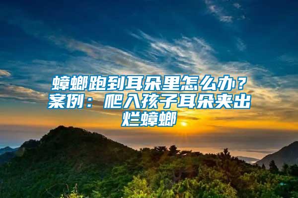 蟑螂跑到耳朵里怎么辦？案例：爬入孩子耳朵夾出爛蟑螂